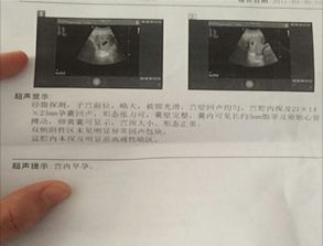 大概几天能察觉怀孕了