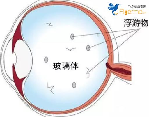 1.年龄因素